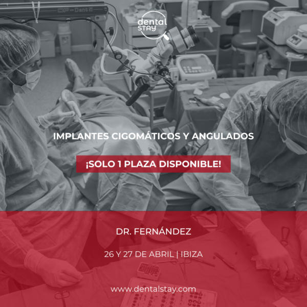 Implantes Cigomáticos y Angula …