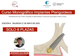 Curso Monográfico Implantes Pt …
