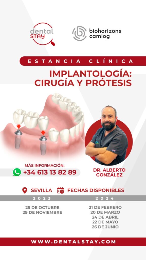 ESTANCIA EN IMPLANTOLOGIA LA FORMACIÓN DE LOS EXPERTOS