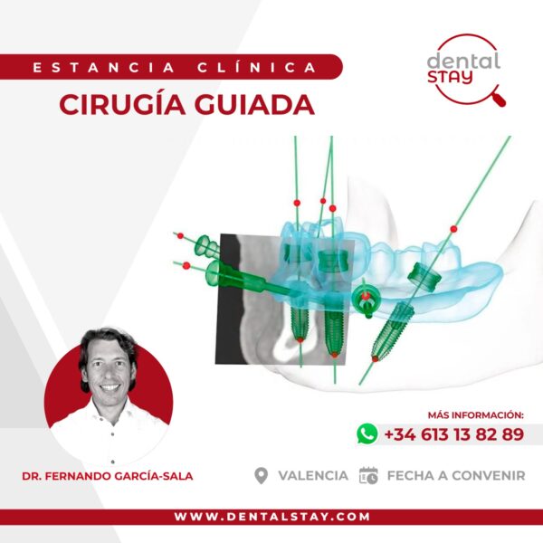 CIRUGIA GUIADA